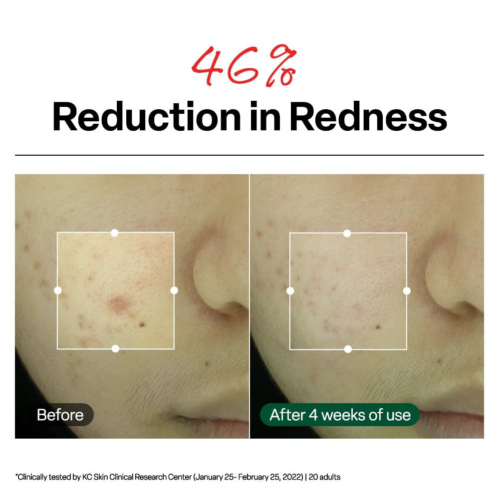 Dr. G R.E.D. Blemish Clear Soothing Cream – Calming Centella Moisturizer for Redness & Irritation (2.36 fl oz)
